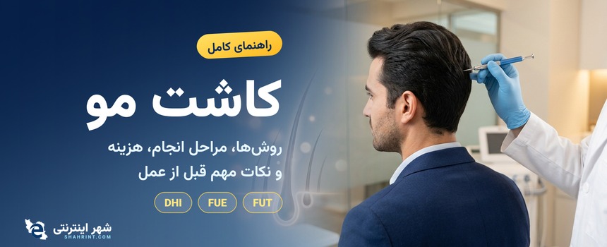کاشت مو چیست؟ روش‌ها، مراحل انجام، هزینه و مراقبت‌ها