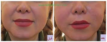 تصویر 11 کلینیک زیبایی دکتر مسعود زاهدی