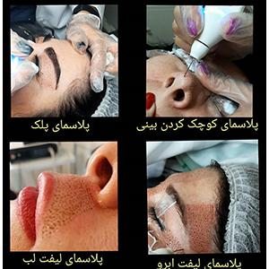مرکز پوست و مو  قاصدک زعفرانیه در  زعفرانیه محمودیه