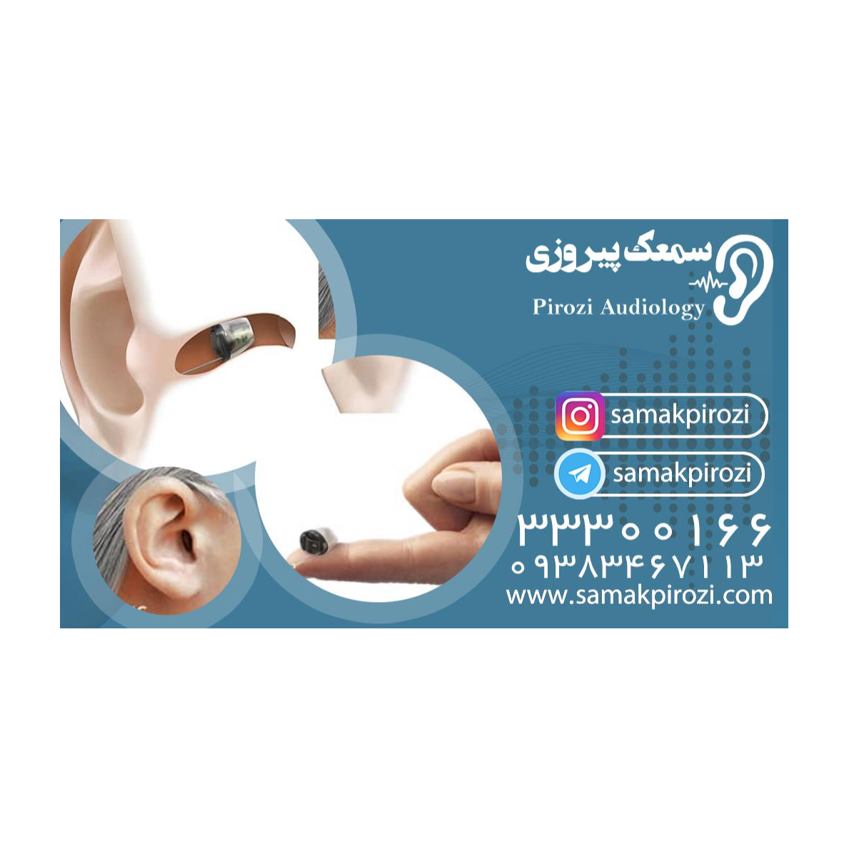 تصویر 2 کلینیک شنوایی و سمعک زارع