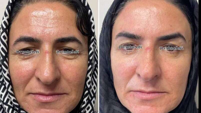 کلینیک زیبایی دکتر م... در پیروزی پرستار بلوار ابوذر شمالی