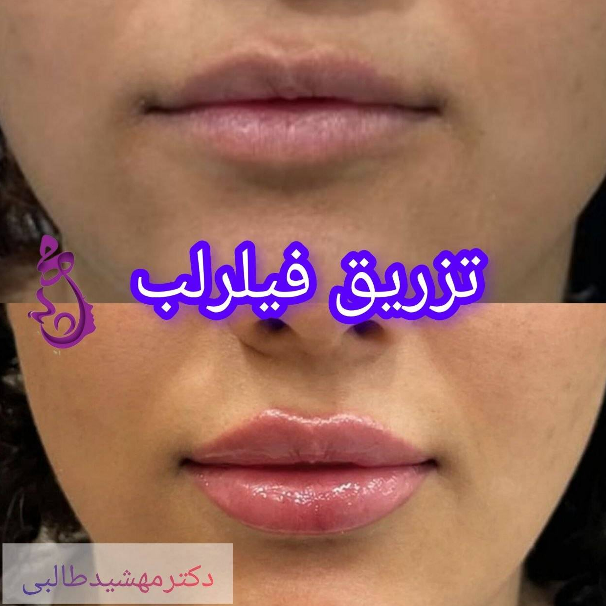 تصویر 5 کلینیک زیبایی دکتر مهشید طالبی