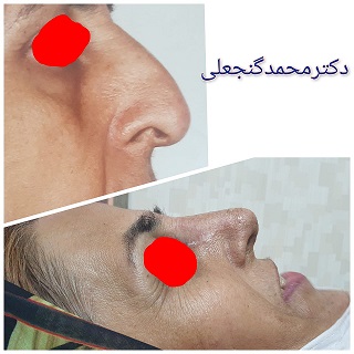 متخصص گوش و حلق بینی... در پیروزی پرستار بلوار ابوذر شمالی