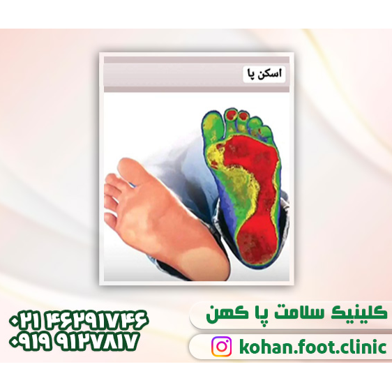 تصویر 11 سلامت پا کهن فوت