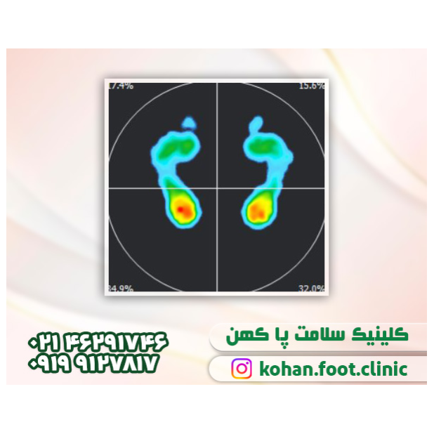 تصویر 16 سلامت پا کهن فوت