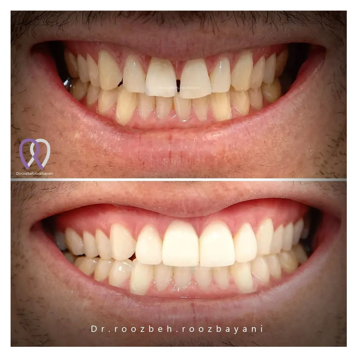 تصویر 8 دندانپزشکی دکتر روزبه روزبیانی
