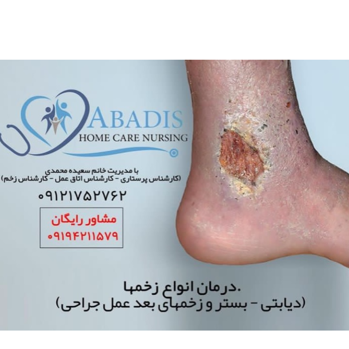 تصویر 6 درمان زخم آبادیس