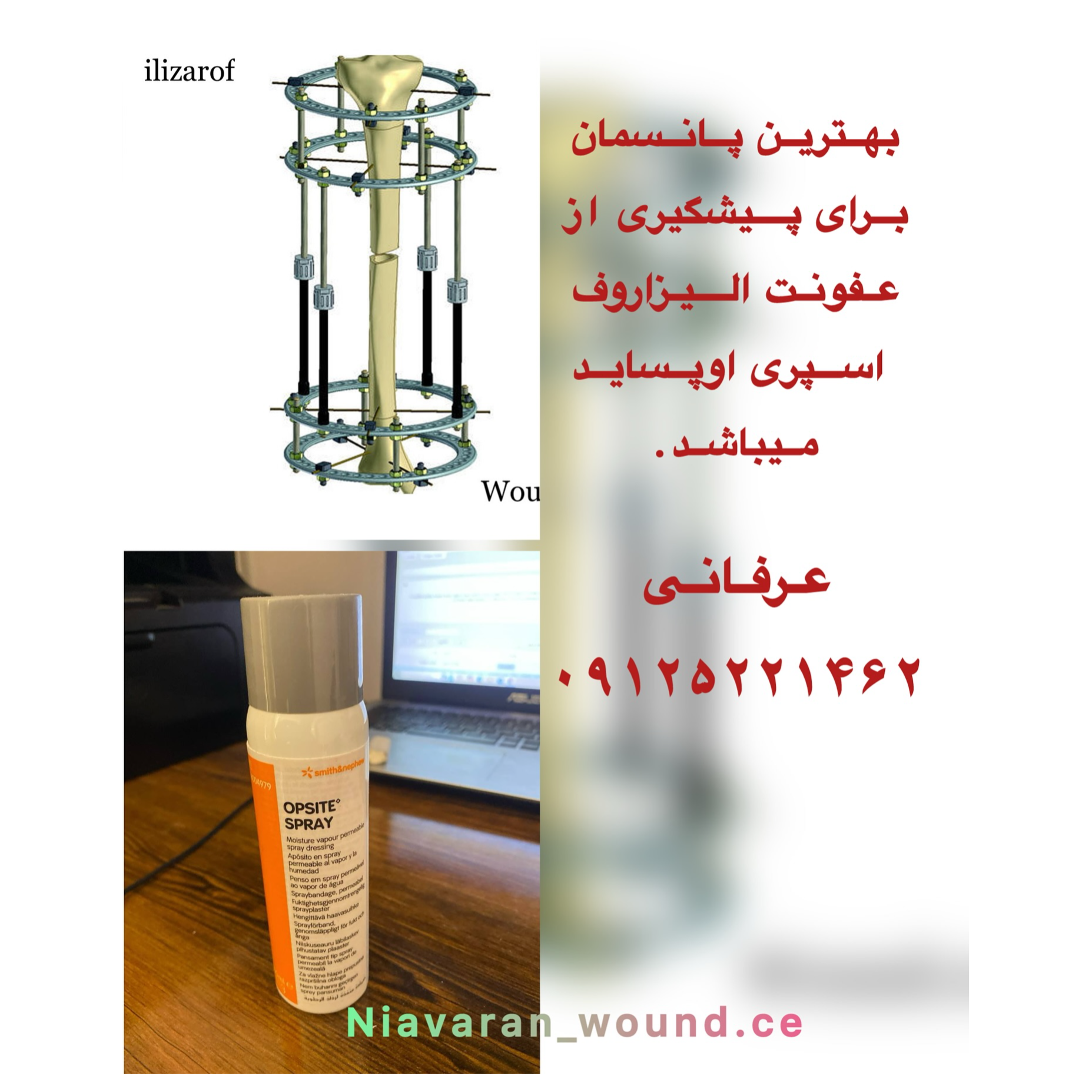 تصویر 7 مرکز درمانی زخم و ازون تراپی نیاوران