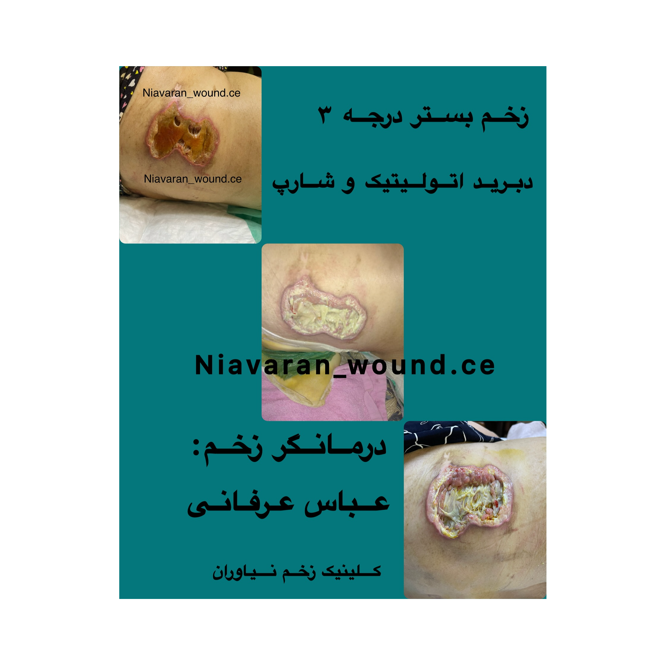 تصویر 8 مرکز درمانی زخم و ازون تراپی نیاوران