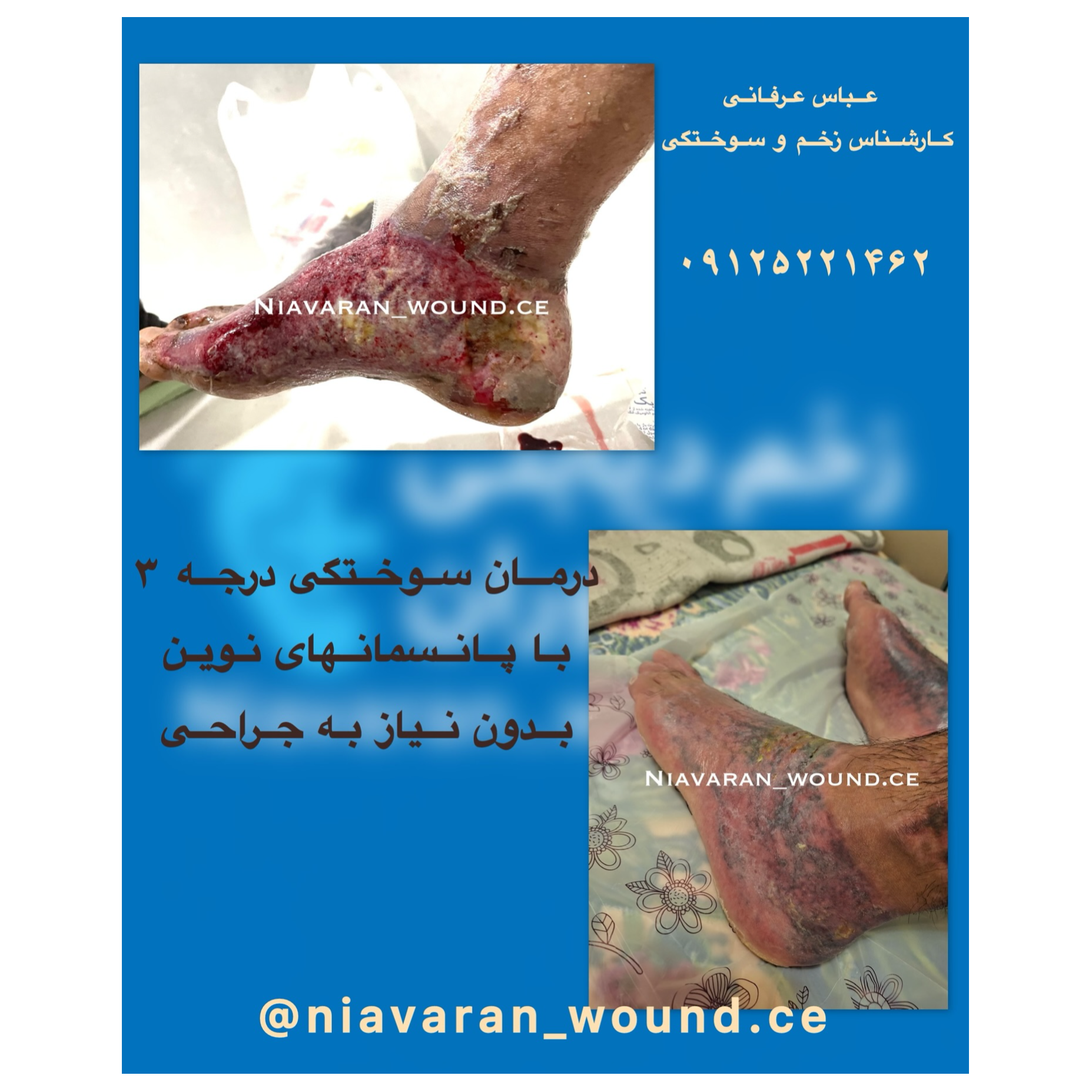 تصویر 9 مرکز درمانی زخم و ازون تراپی نیاوران