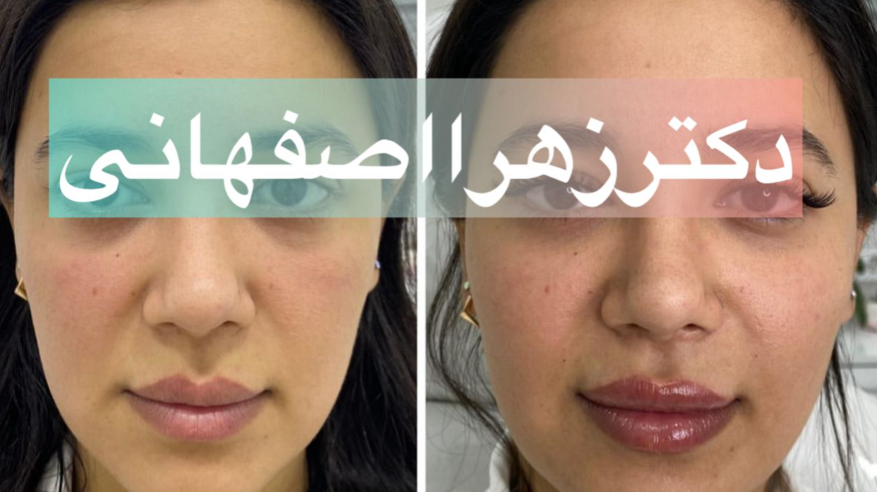 لوکیشن کلینیک ونوس مشیریه