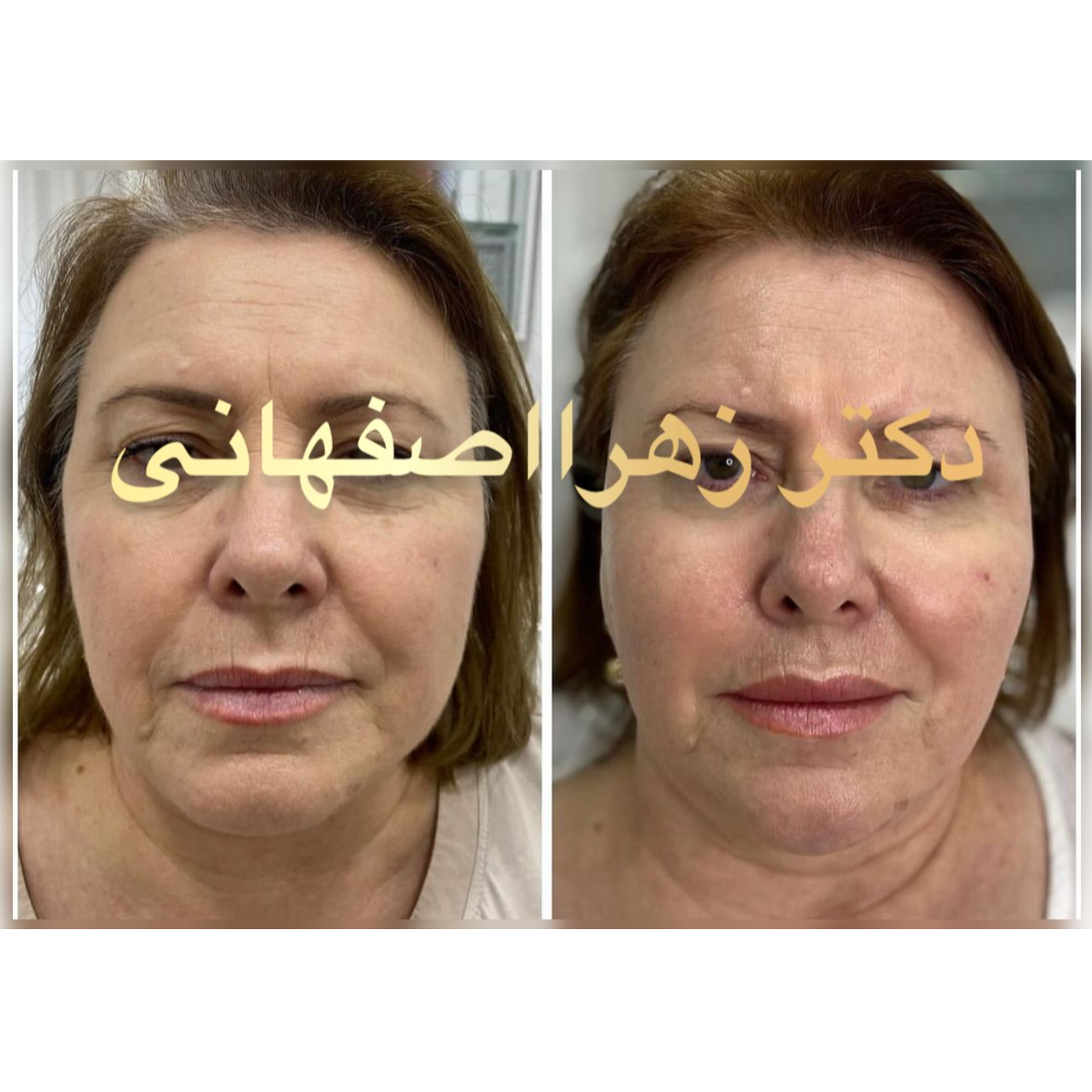 تصویر 5 کلینیک لیزر و زیبایی ونوس (دکتر زهرا اصفهانی)