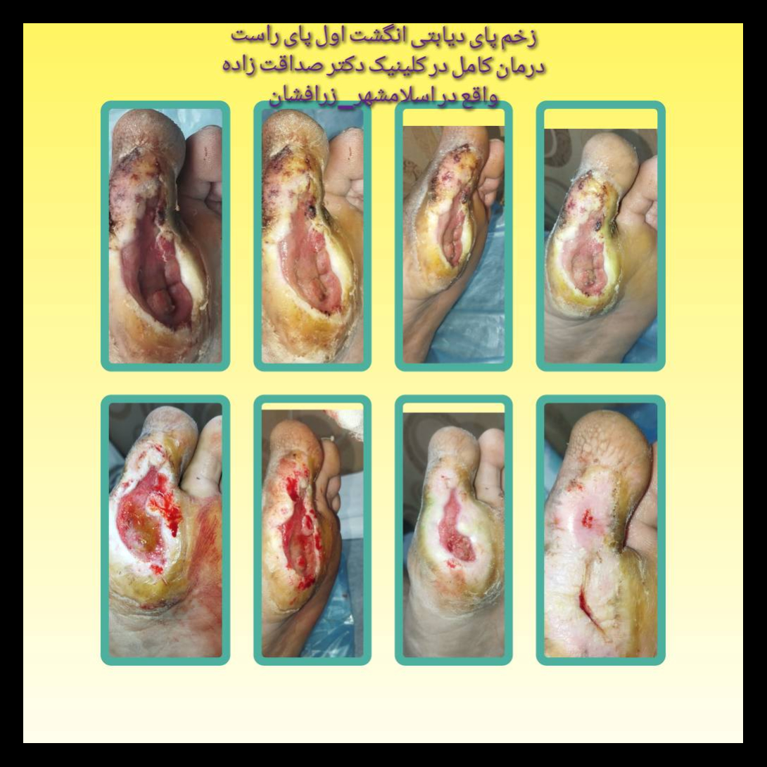 تصویر 8  کلینیک زخم و بیماری های عفونی دکتر صداقت زاده