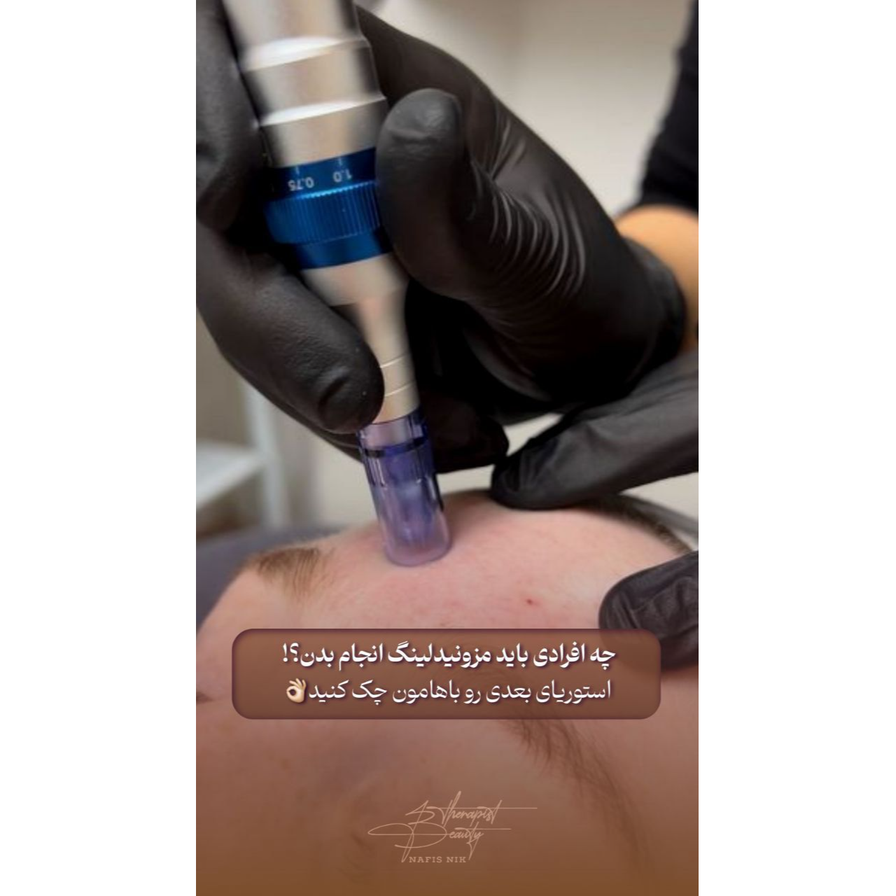 تصویر 2 فیشال تخصصی و پاکسازی عمقی پوست نفیس