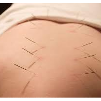 تصویر 5 کلینیک طب سوزنی دکتر اشرف واثق نیا