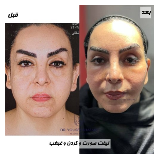 تصویر 1 دکتر یوسف شفائی