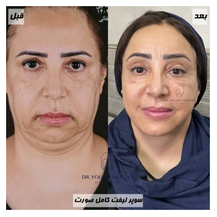 تصویر 2 دکتر یوسف شفائی