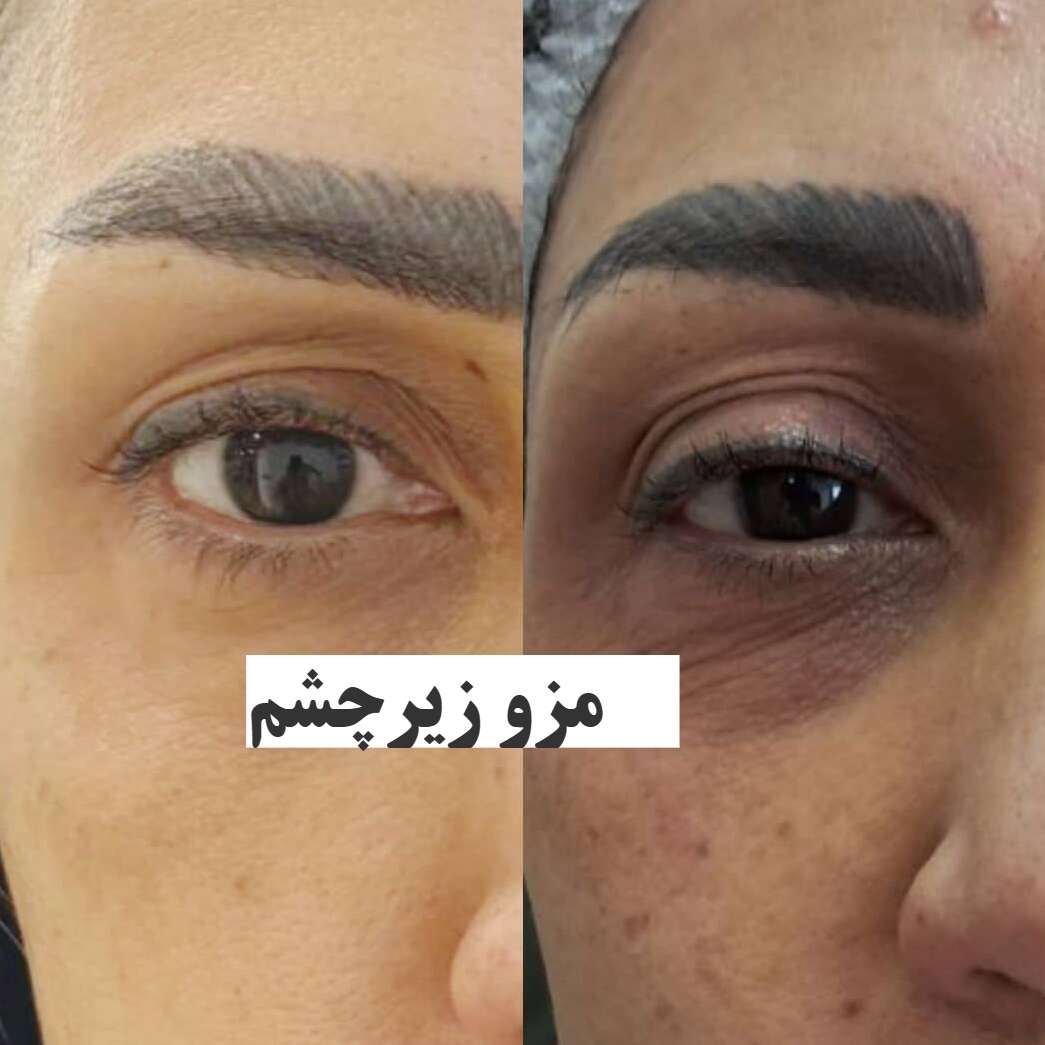 تصویر 5 کلینیک زیبایی آرالیا با خدمات تخصصی پوست زیبایی