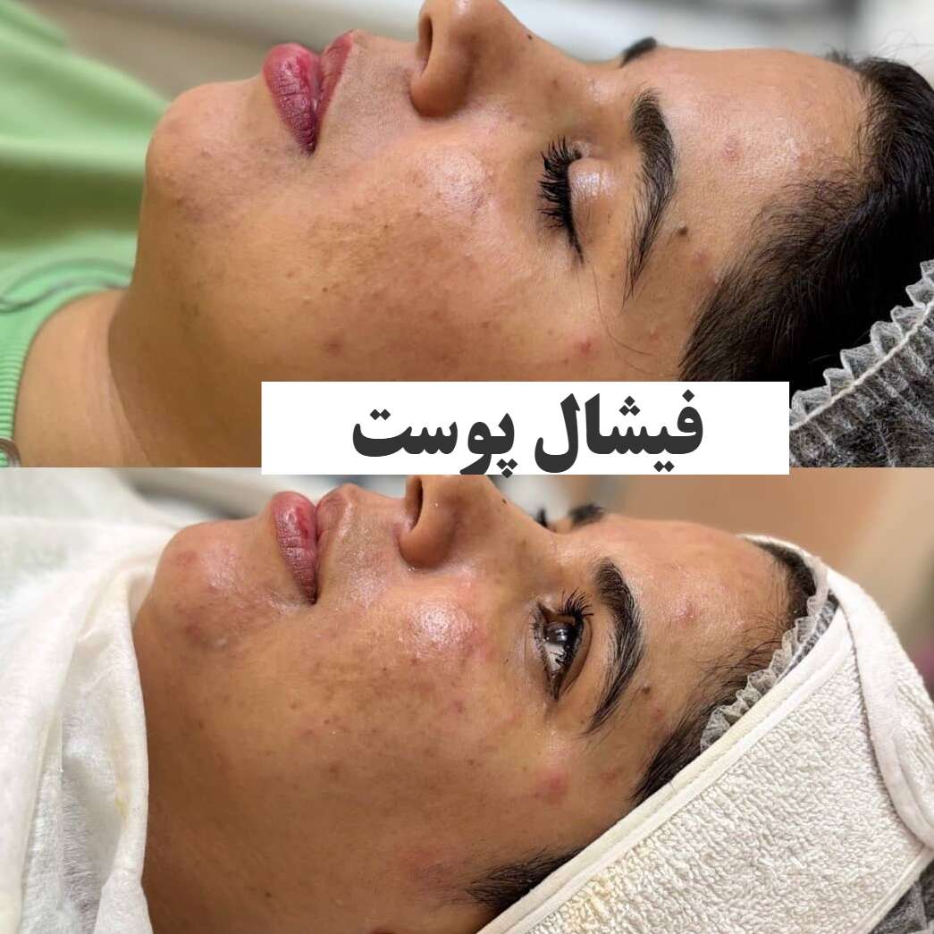 تصویر 6 کلینیک زیبایی آرالیا با خدمات تخصصی پوست زیبایی