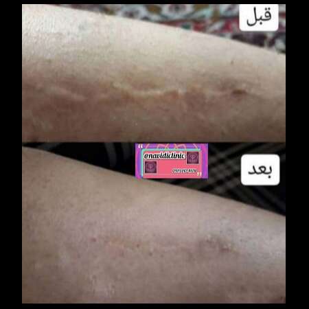 تصویر 5 کلینیک درمان زخم  دکتر علی نویدی
