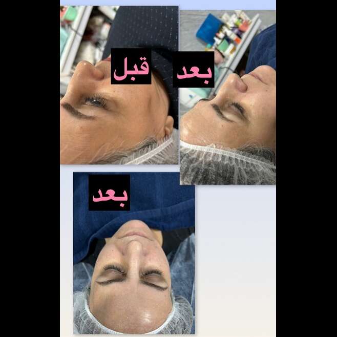 تصویر 6 فشیال تخصصی و جوانسازی پوست سمیرا شیدایی