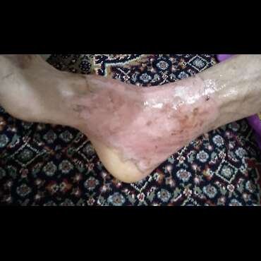 تصویر 4 کلینیک زخم  بیمارستان حضرت آیت الله گلپایگانی 