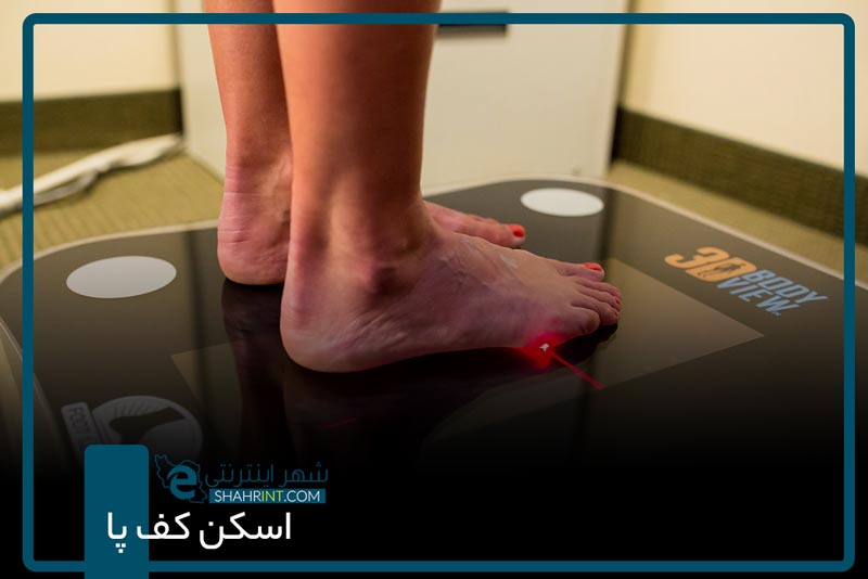 اسکن کف پا در شرق تهران