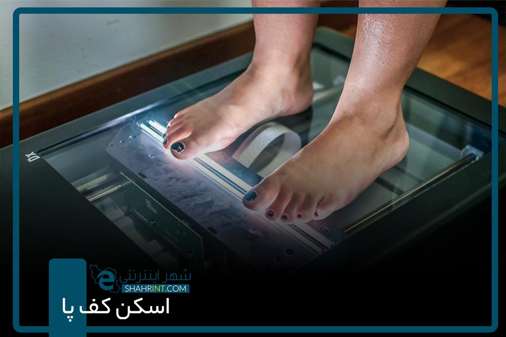 اسکن کف پا در شرق تهران
