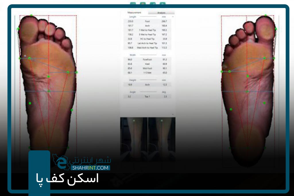اسکن کف پا در شرق تهران
