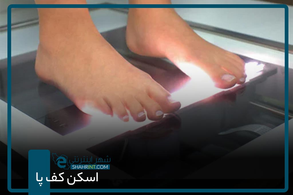 اسکن کف پا در شرق تهران