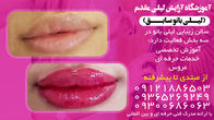 تصویر 4 مرکز فوق تخصصی عروس لیلی مقدم (لیلی بانو سابق) 