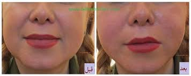 تصویر 11 کلینیک زیبایی دکتر مسعود زاهدی