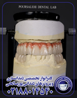 تصویر 1 لابراتوار تخصصی دندانسازی و پروتزهای دندانی پورصالحی