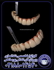 تصویر 4 لابراتوار تخصصی دندانسازی و پروتزهای دندانی پورصالحی