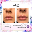 تصویر 1 کلینیک زیبایی دکتر زهرا آزادی 
