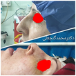 تصویر 2 متخصص گوش و حلق بینی دکتر محمد گنجعلی 