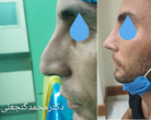 تصویر 4 متخصص گوش و حلق بینی دکتر محمد گنجعلی 