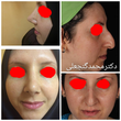 تصویر 7 متخصص گوش و حلق بینی دکتر محمد گنجعلی 