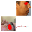 تصویر 8 متخصص گوش و حلق بینی دکتر محمد گنجعلی 