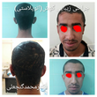 تصویر 14 متخصص گوش و حلق بینی دکتر محمد گنجعلی 