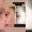 تصویر 8 سالن زیبایی پری