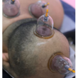 تصویر 1 طب سوزنی و طب سنتی  دکتر طبسی 