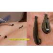 تصویر 4 طب سوزنی و طب سنتی  دکتر طبسی 