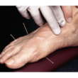 تصویر 7 طب سوزنی و طب سنتی  دکتر طبسی 