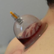 تصویر 8 طب سوزنی و طب سنتی  دکتر طبسی 