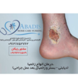 تصویر 3 درمان زخم آبادیس