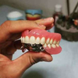 تصویر 4 لابراتوار دندانسازی امین