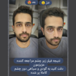 تصویر 1 کلینیک لیزر و زیبایی نفیسه پناه