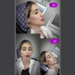 تصویر 2 کلینیک لیزر و زیبایی نفیسه پناه