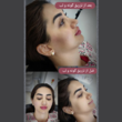 تصویر 4 کلینیک لیزر و زیبایی نفیسه پناه